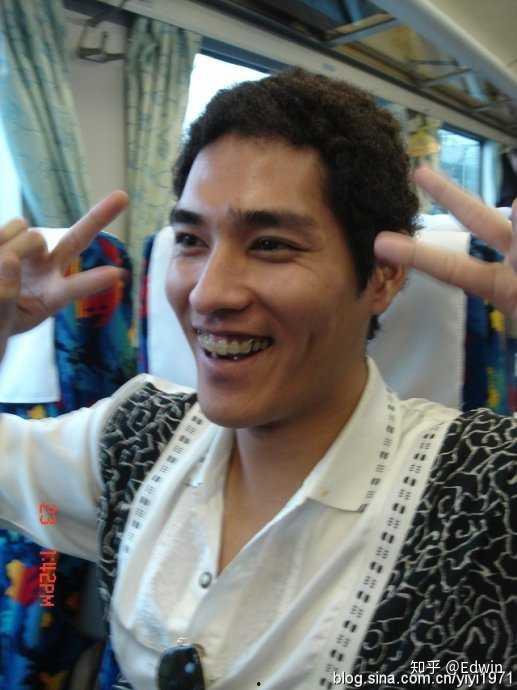 明星戴白牙套,闪耀蜕变之路